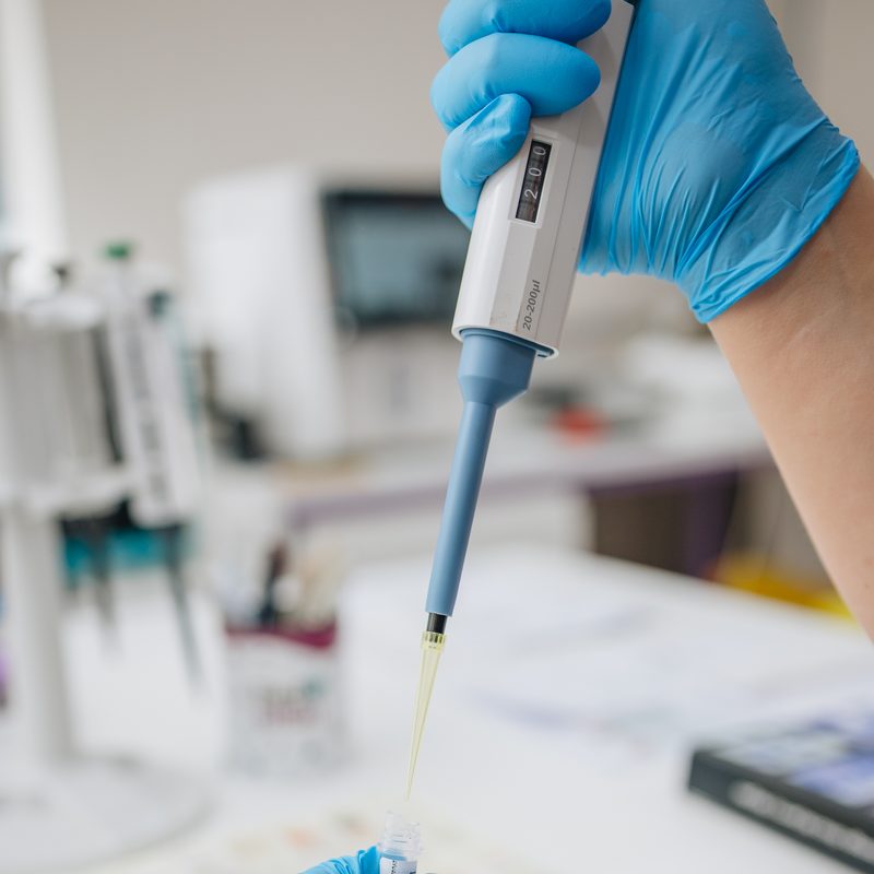 Procesamiento de muestras con micropipeta en el laboratorio Redbital