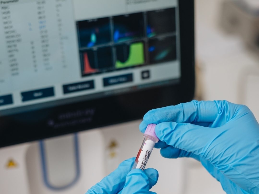 creative-approach-img